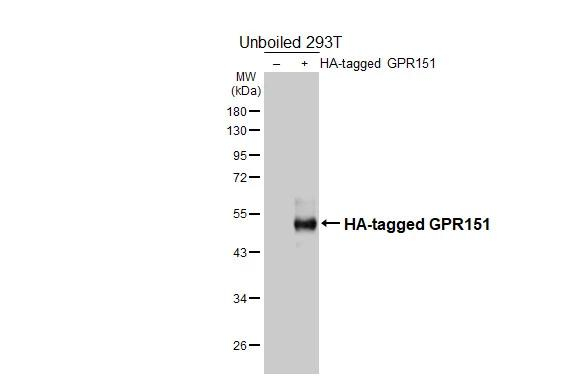 GPR151 Antibody in Western Blot (WB)