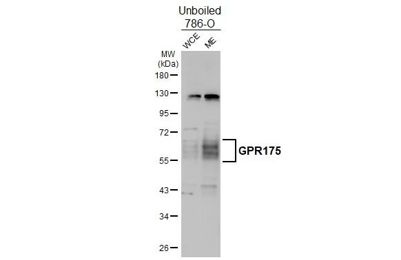 TPRA1 Antibody in Western Blot (WB)