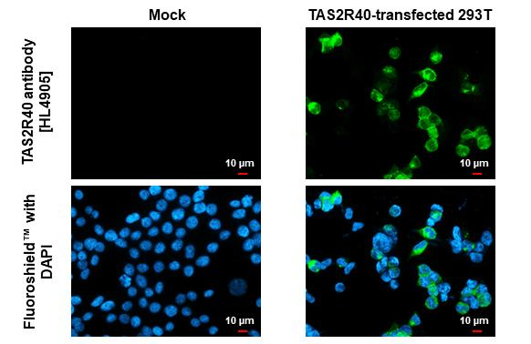TAS2R40 Antibody in Immunocytochemistry (ICC/IF)