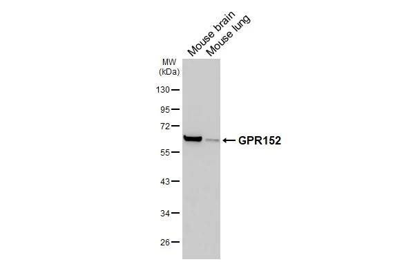 GPR152 Antibody in Western Blot (WB)