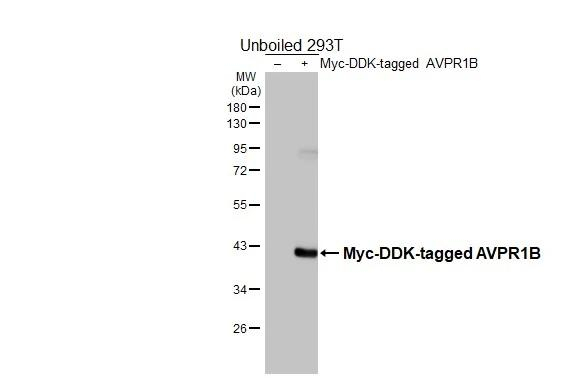 AVPR1B Antibody in Western Blot (WB)