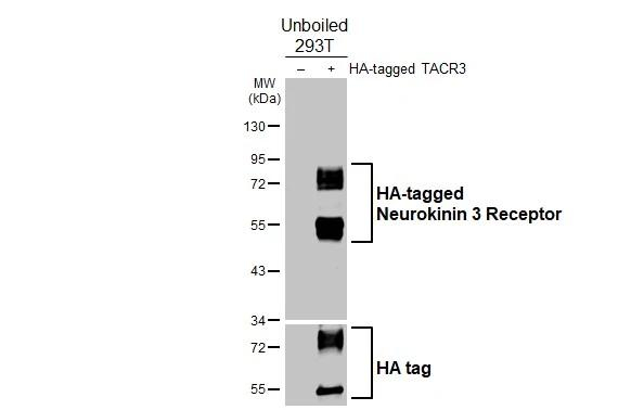 TACR3 Antibody in Western Blot (WB)