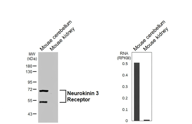 TACR3 Antibody in Western Blot (WB)