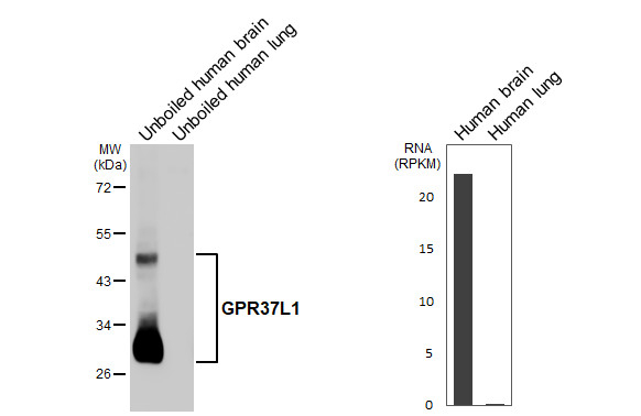 GPR37L1 Antibody in Western Blot (WB)