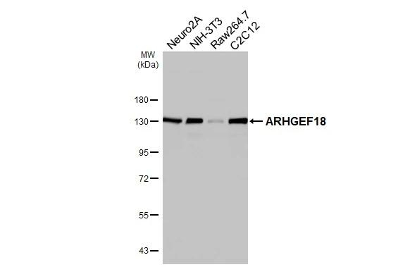 ARHGEF18 Antibody in Western Blot (WB)