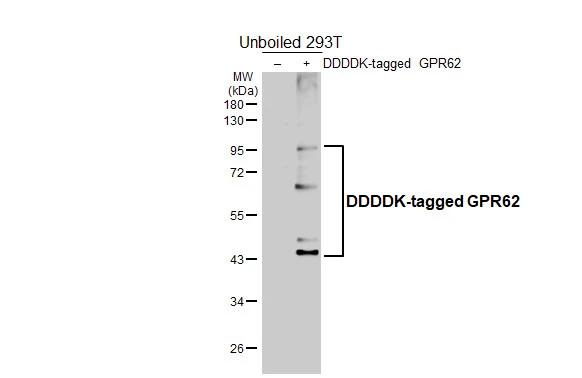 GPR62 Antibody in Western Blot (WB)