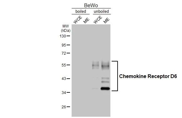 CCRD6 Antibody in Western Blot (WB)
