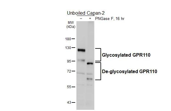 GPR110 Antibody in Western Blot (WB)