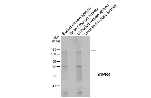 EDG6 Antibody in Western Blot (WB)