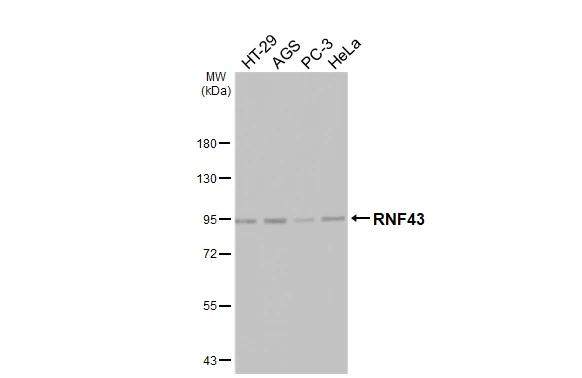 RNF43 Antibody in Western Blot (WB)