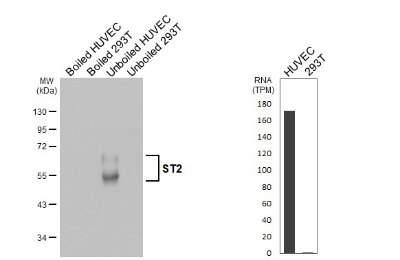 ST2 Antibody in Western Blot (WB)