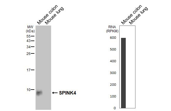 SPINK4 Antibody in Western Blot (WB)