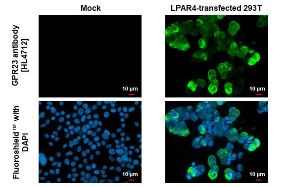 LPAR4 Antibody in Immunocytochemistry (ICC/IF)