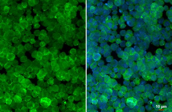 RAB27B Antibody in Immunocytochemistry (ICC/IF)