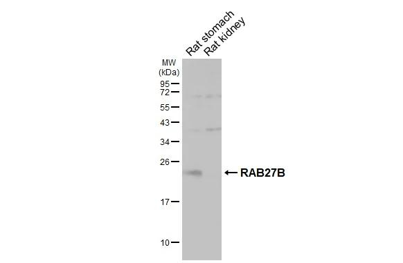 RAB27B Antibody in Western Blot (WB)