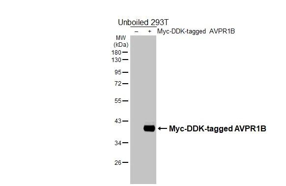 AVPR1B Antibody in Western Blot (WB)