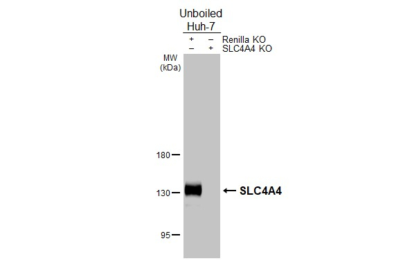 SLC4A4 Antibody in Western Blot (WB)