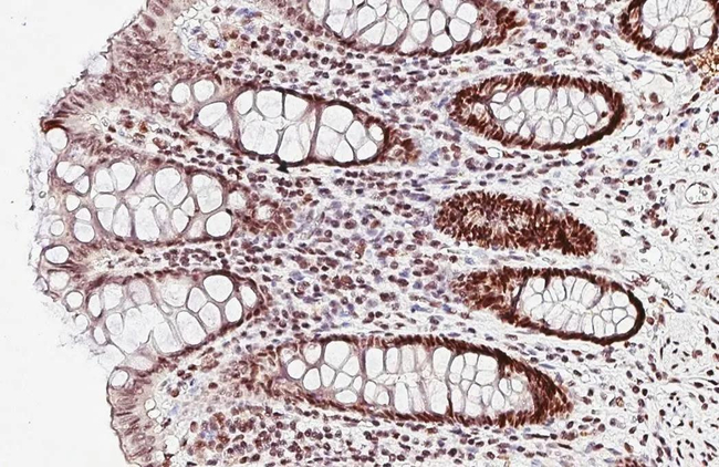 MSH6 Antibody in Immunohistochemistry (Paraffin) (IHC (P))