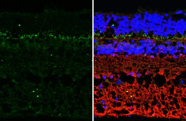 mGluR6 Antibody in Immunohistochemistry (Paraffin) (IHC (P))