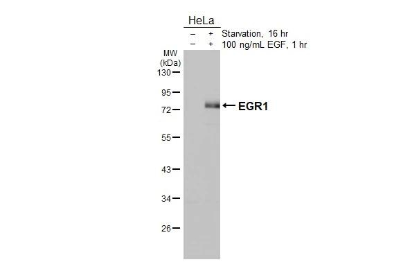 EGR1 Antibody in Western Blot (WB)