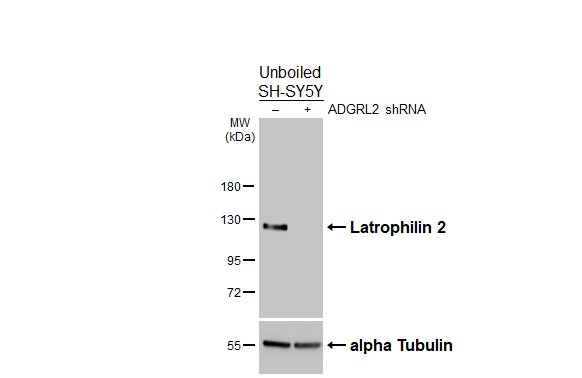 LPHN2 Antibody in Western Blot (WB)