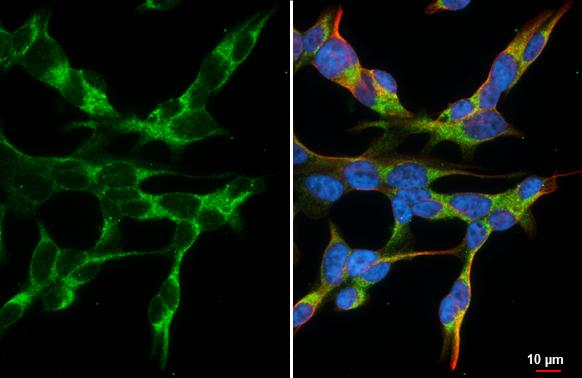 GBA Antibody in Immunocytochemistry (ICC/IF)