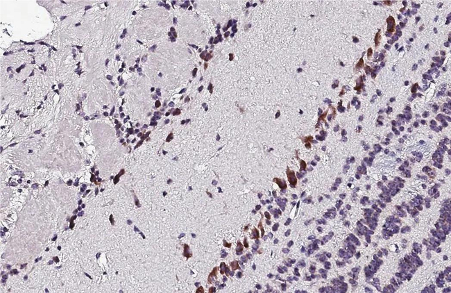 HTR2C Antibody in Immunohistochemistry (Paraffin) (IHC (P))