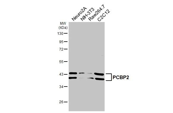 PCBP2 Antibody in Western Blot (WB)