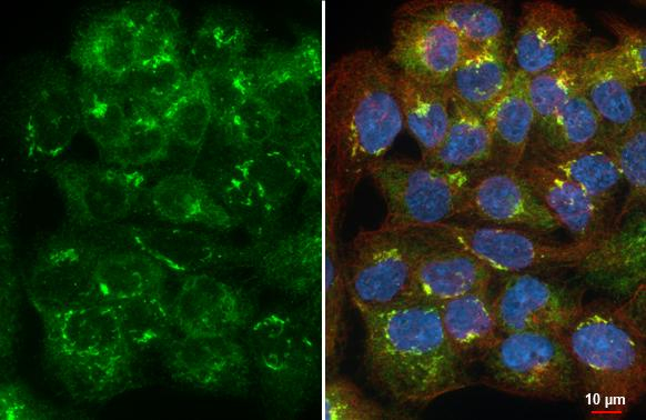 STIM1 Antibody in Immunocytochemistry (ICC/IF)