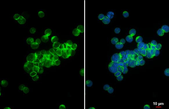 STIM1 Antibody in Immunocytochemistry (ICC/IF)