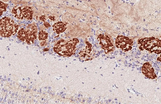 GABBR2 Antibody in Immunohistochemistry (Paraffin) (IHC (P))