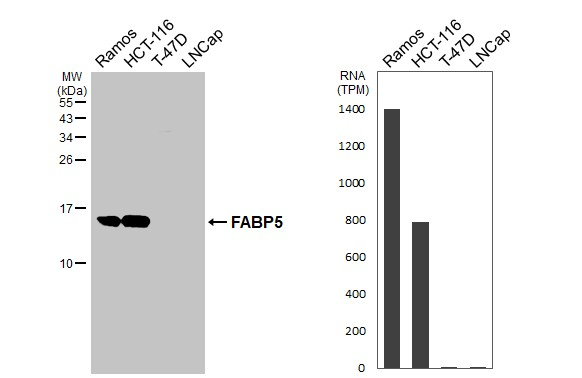 FABP5 Antibody in Western Blot (WB)