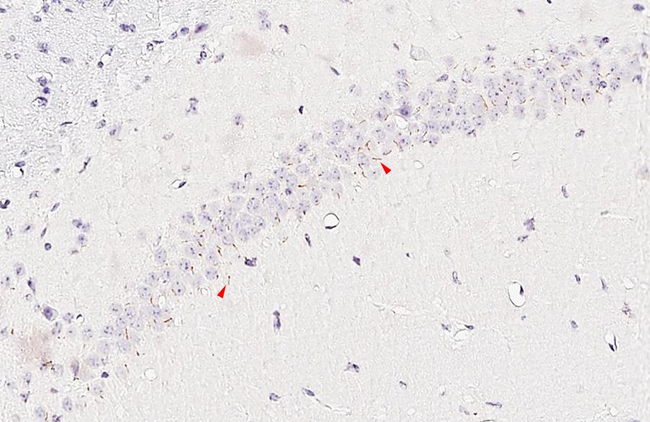 MCHR1 Antibody in Immunohistochemistry (Paraffin) (IHC (P))