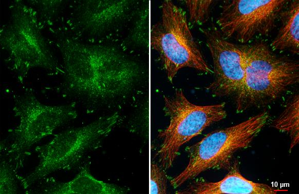 Paxillin Antibody in Immunocytochemistry (ICC/IF)