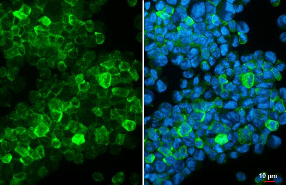 CX3CR1 Antibody in Immunocytochemistry (ICC/IF)