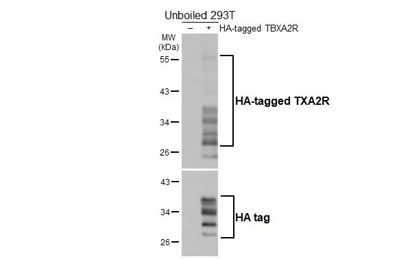 TBXA2R Antibody in Western Blot (WB)
