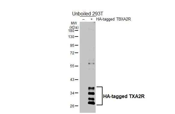 TBXA2R Antibody in Western Blot (WB)