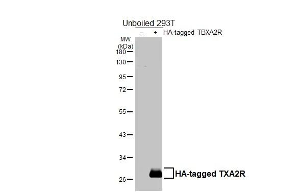 TBXA2R Antibody in Western Blot (WB)