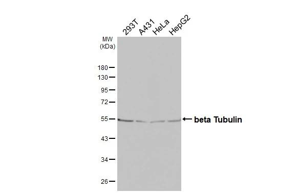 beta Tubulin Antibody in Western Blot (WB)