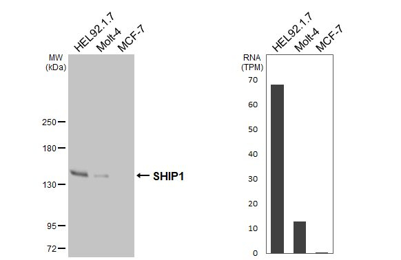 SHIP1 Antibody in Western Blot (WB)