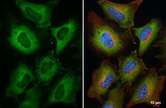 RPL3 Antibody in Immunocytochemistry (ICC/IF)