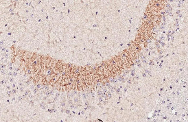 BACE1 Antibody in Immunohistochemistry (Paraffin) (IHC (P))