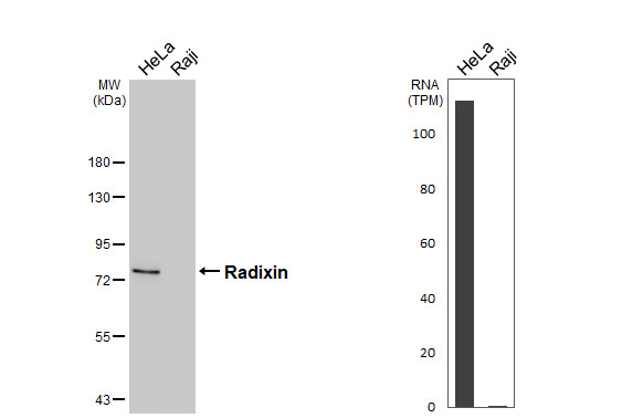 Radixin Antibody in Western Blot (WB)