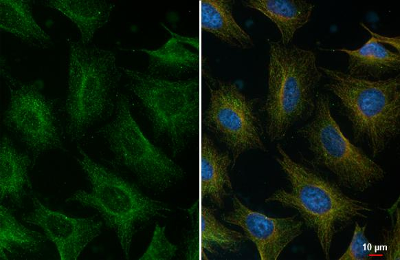 Alix Antibody in Immunocytochemistry (ICC/IF)