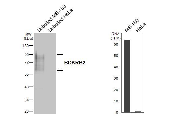 BDKRB2 Antibody in Western Blot (WB)