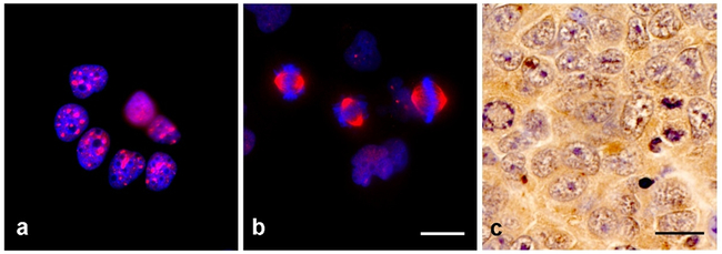 TPX2 Antibody in Immunocytochemistry (ICC/IF)