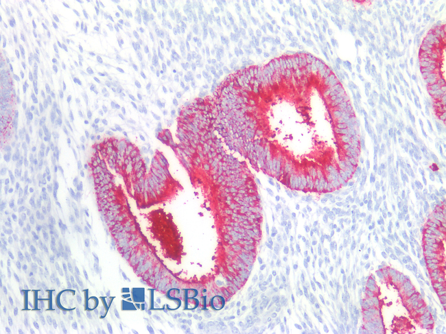 CD15 Antibody in Immunohistochemistry (Paraffin) (IHC (P))
