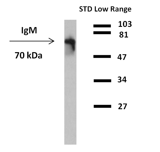 Human IgM Antibody in Western Blot (WB)