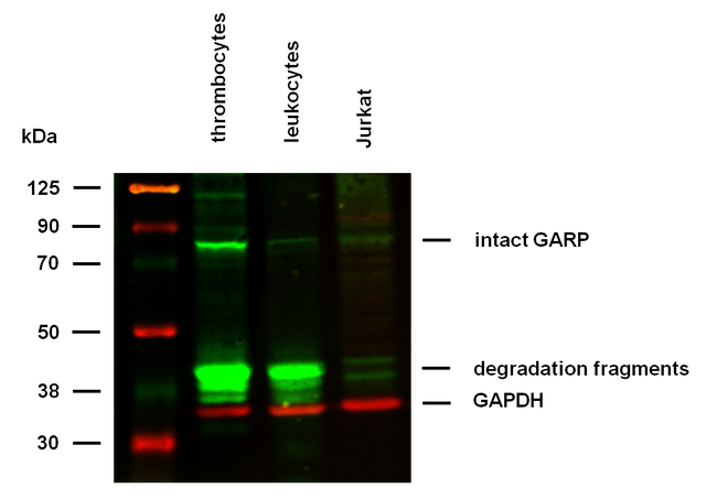 GARP Antibody in Western Blot (WB)