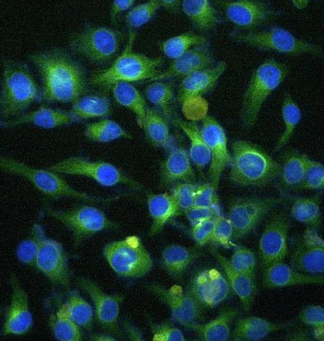 alpha-Tubulin Antibody in Immunocytochemistry (ICC/IF)